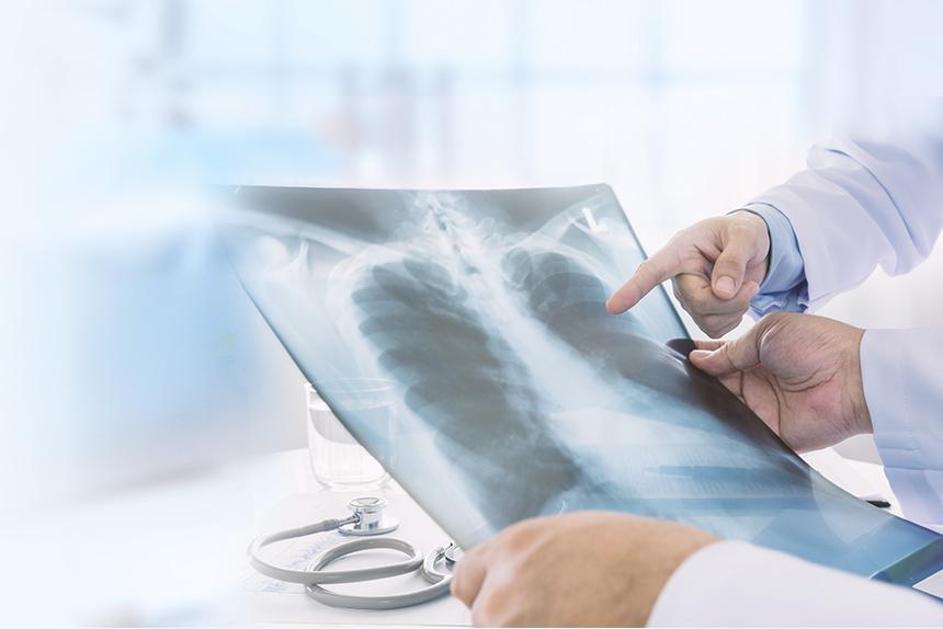 Providers reviewing a lung scan together.
