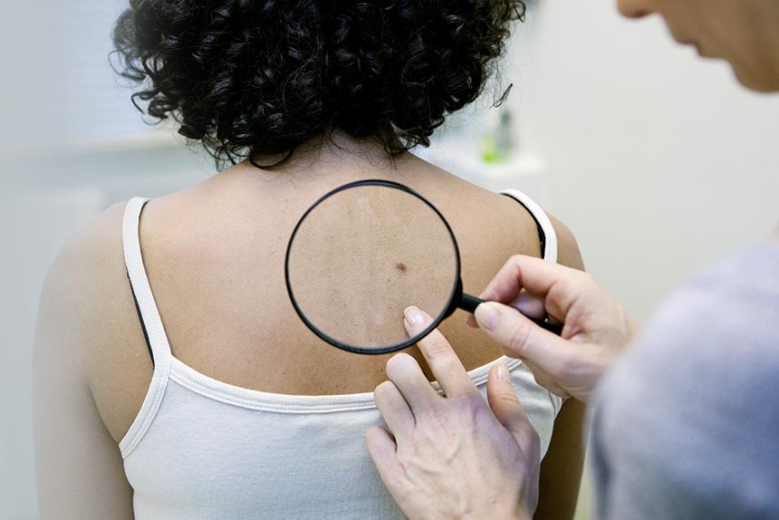 Clinician performing a skin check.